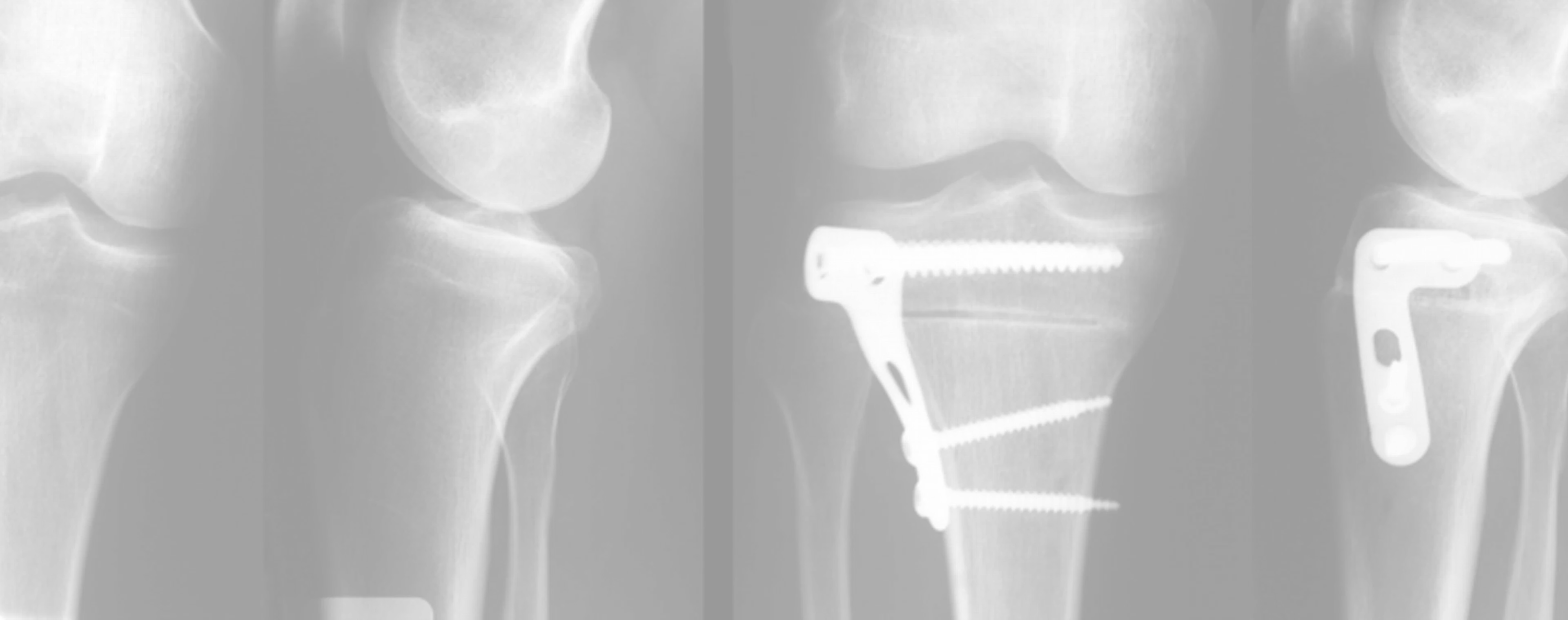 osteostomy - Header Background