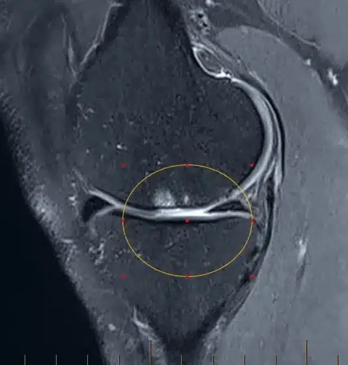 x-rays photograph