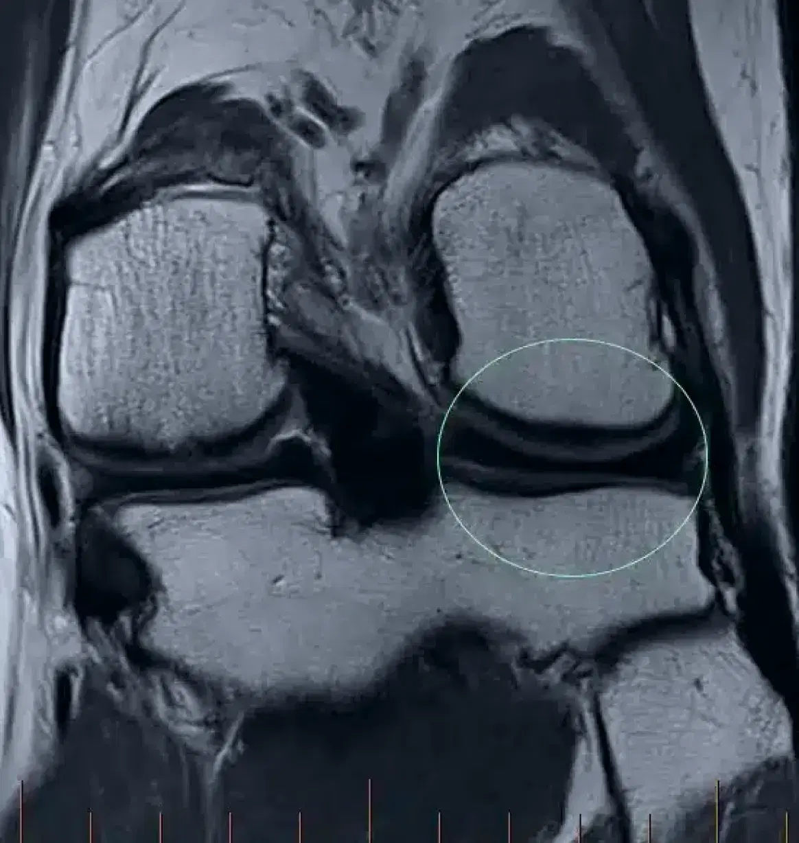 x-rays photograph