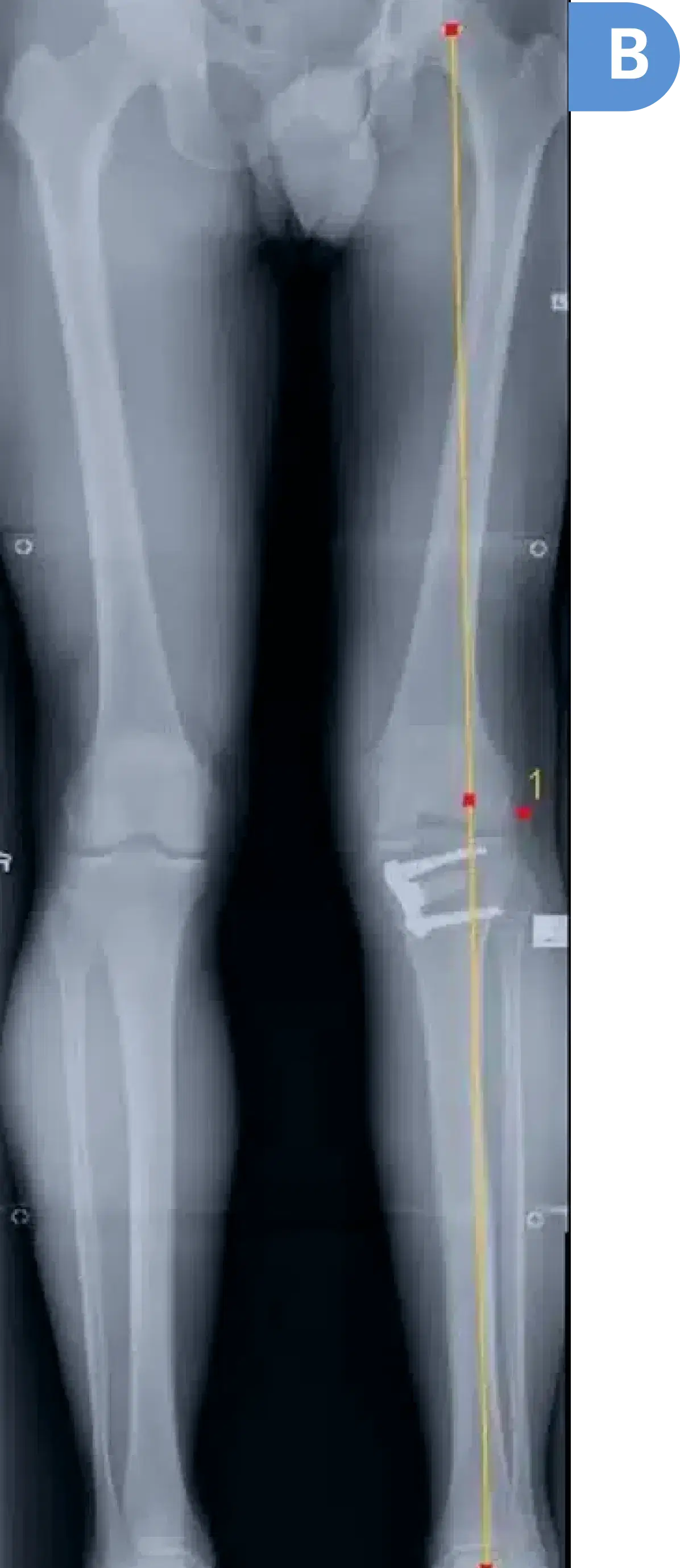x-rays B