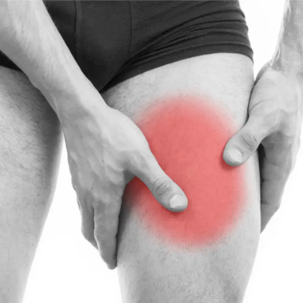 Torn quadriceps or hamstring muscles picture