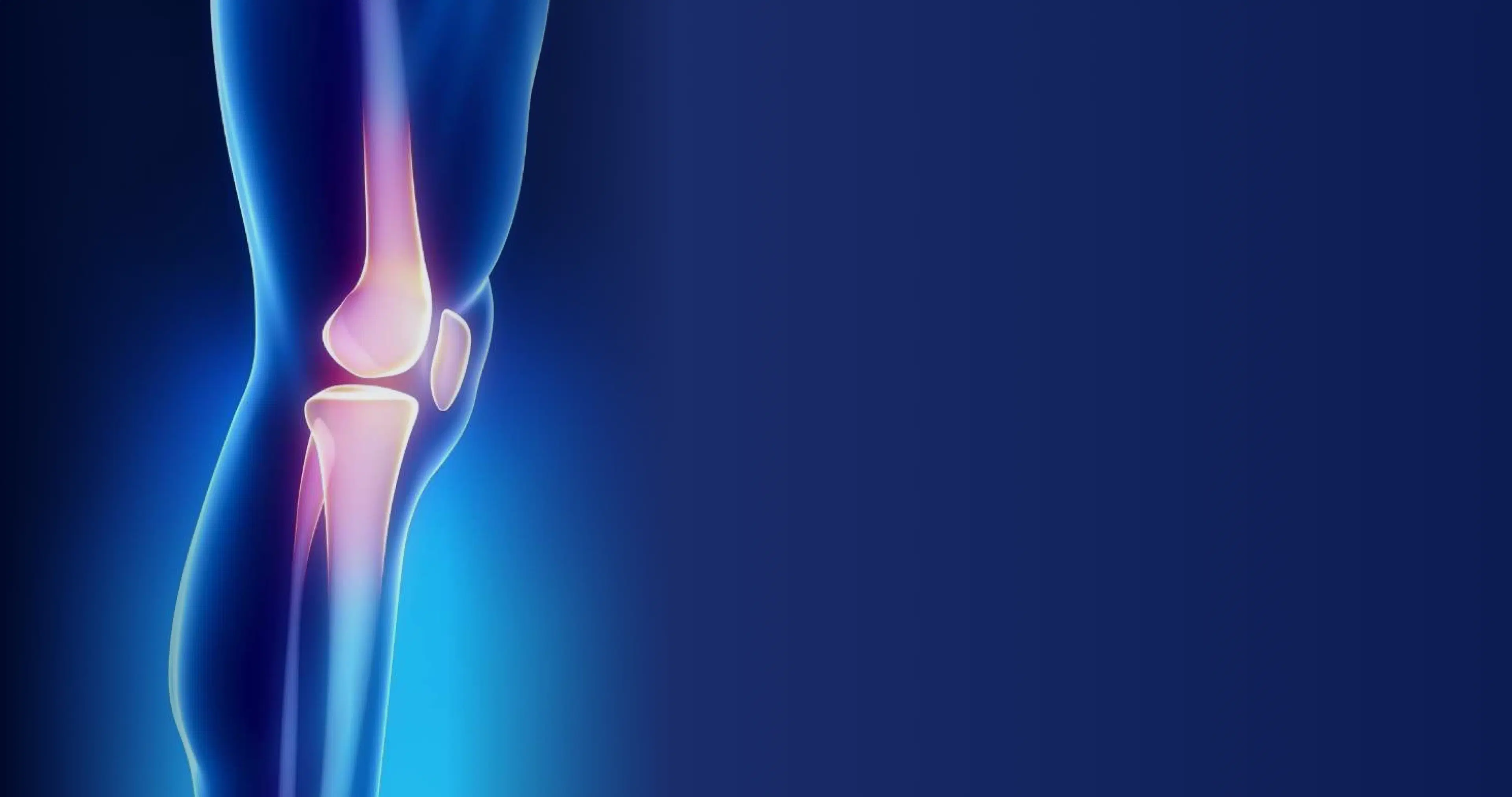 Anterior knee pain banner background