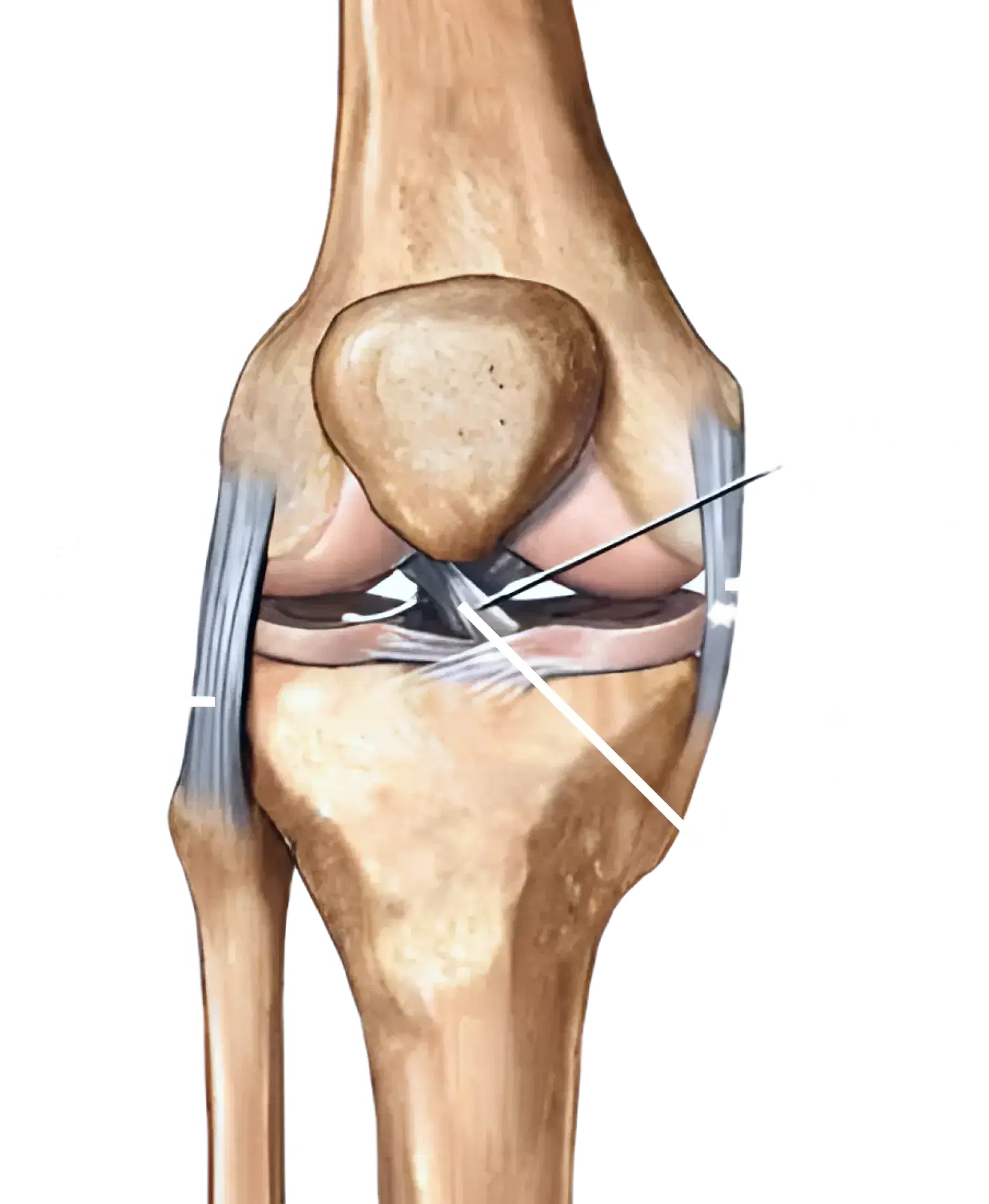 knee Header Mobile