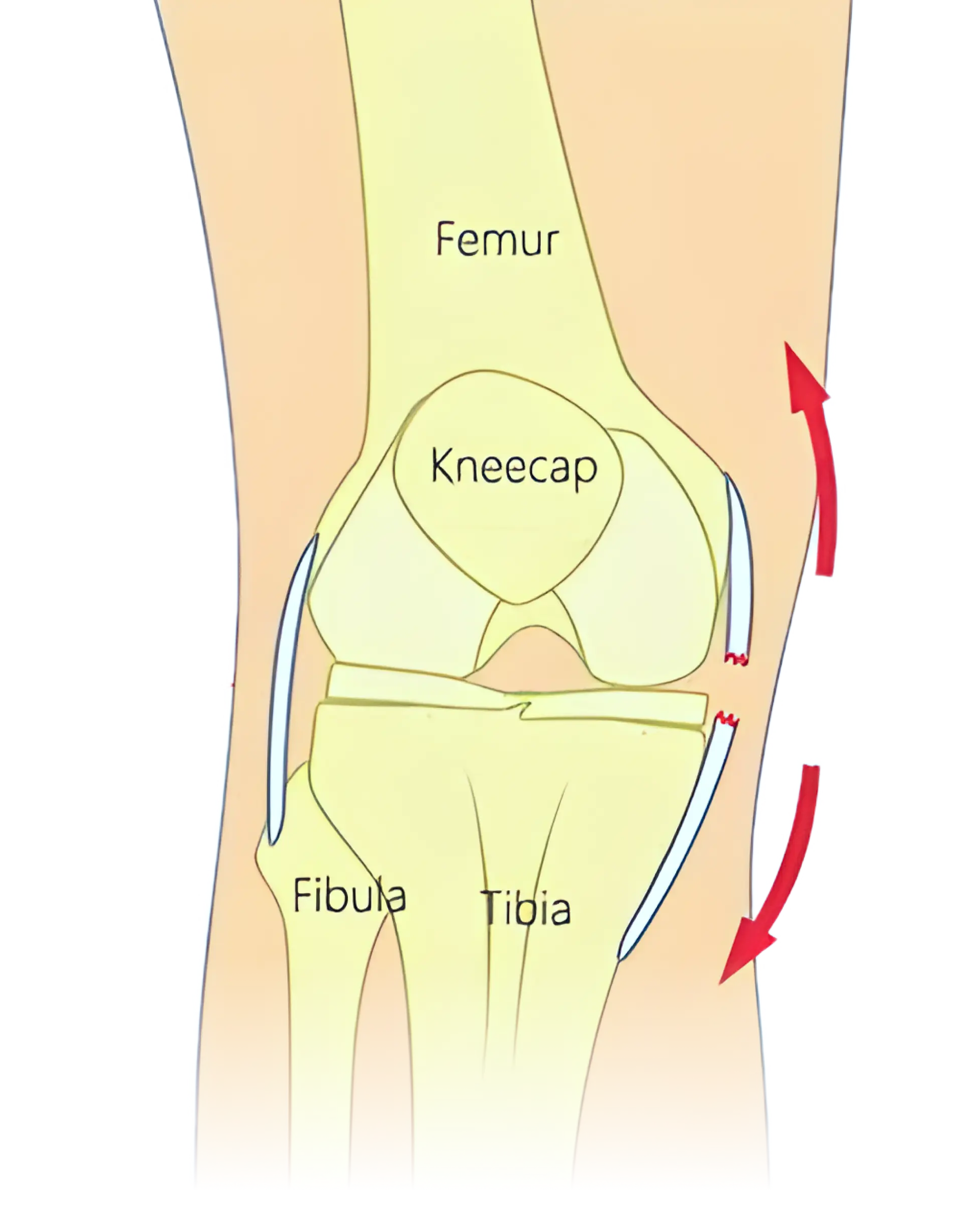 Knee Injury image