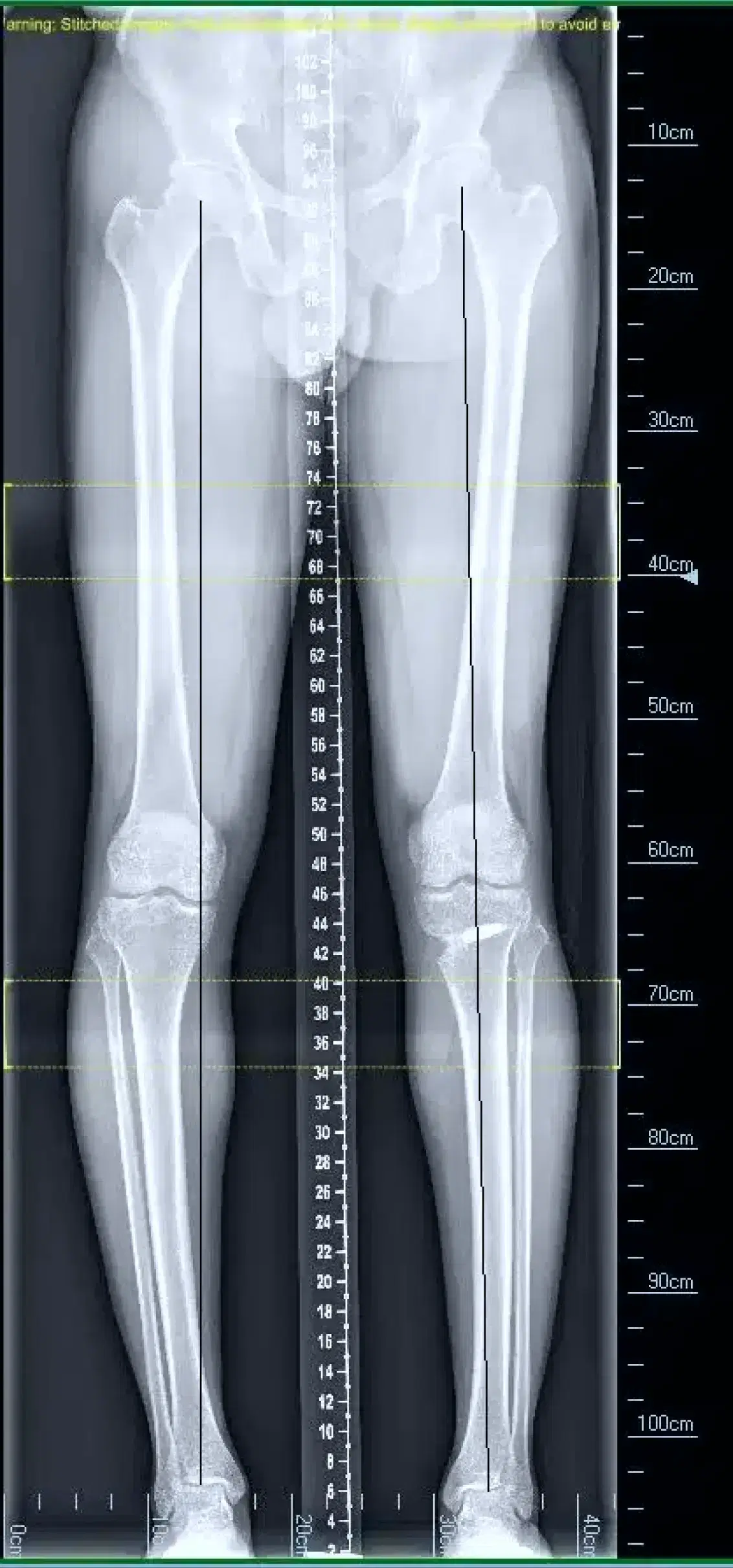 4foot x-ray
