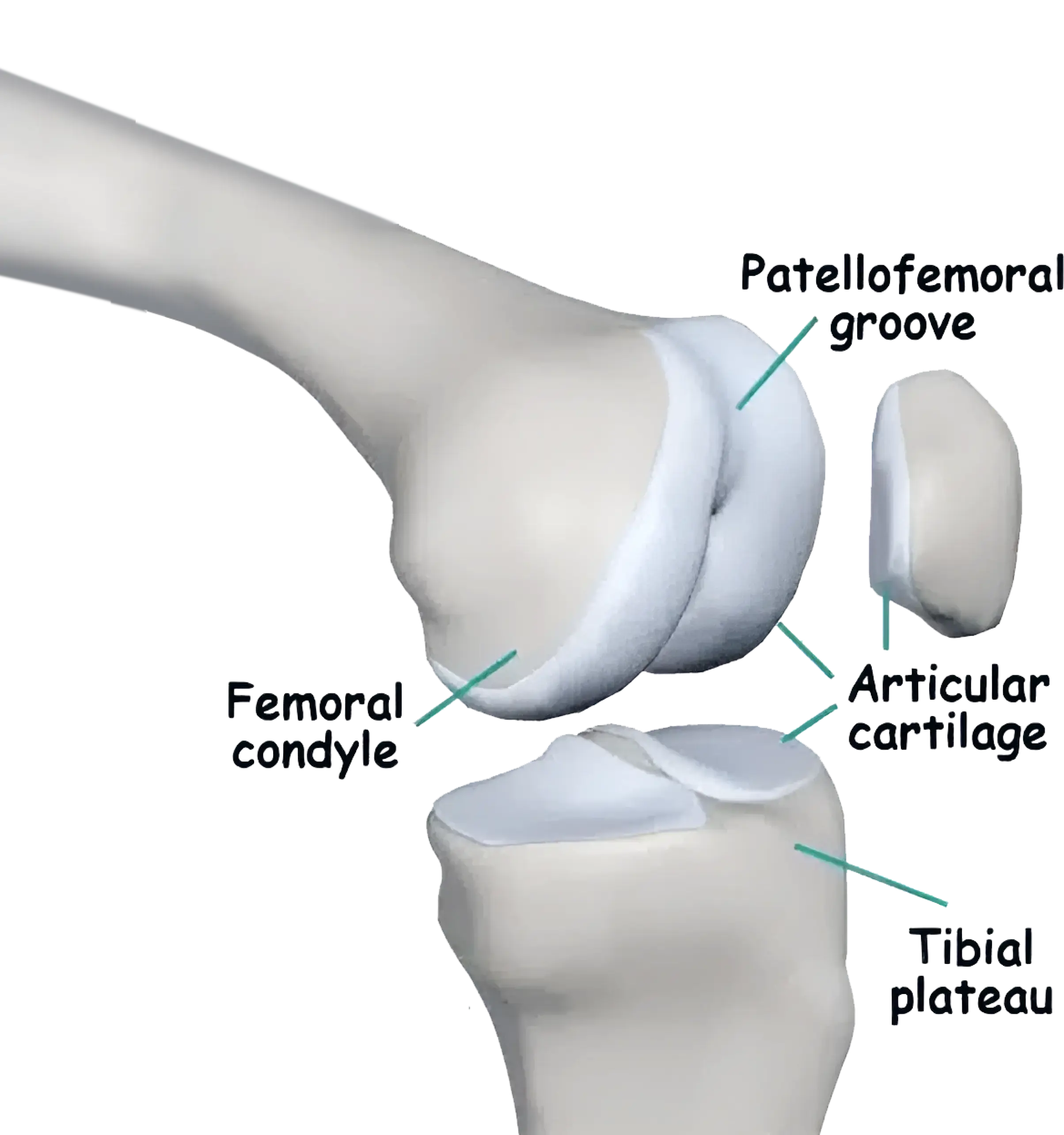Femoral Trochlear Articular Cartilage